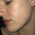 ⁦Earth's Care, بلسم زيت بخلاصة شجرة الشاي⁩ - الصورة ⁦4⁩